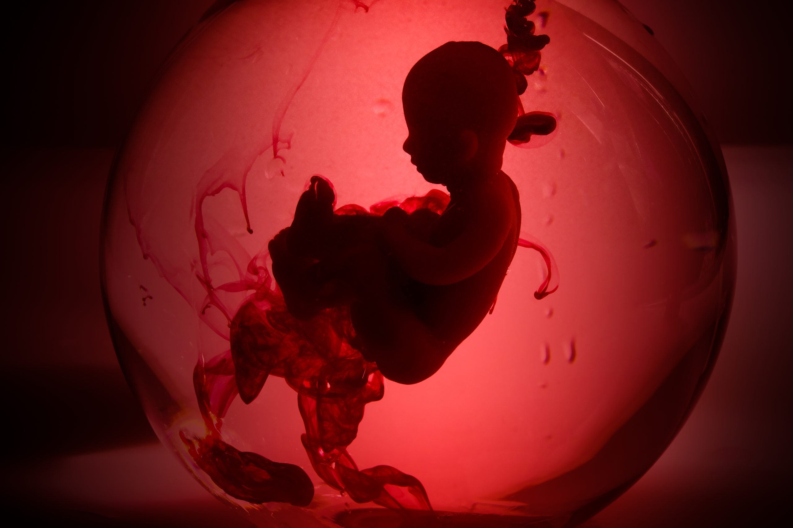 Abortus: Is Islam pro-choice of pro-life?